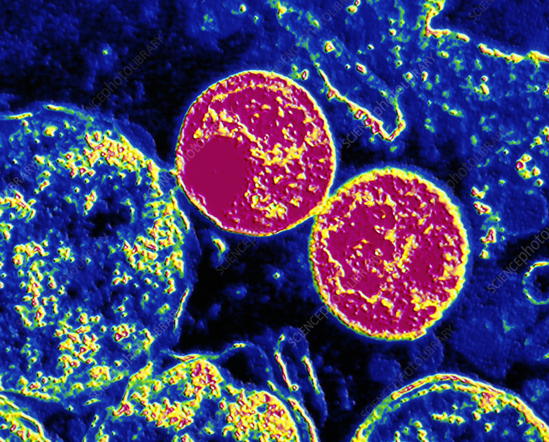 What is LGV? How did I get it? Can LGV be cured?